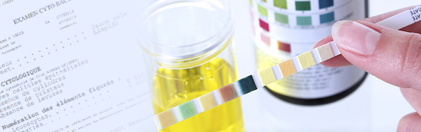 Analyse d'urine ECBU